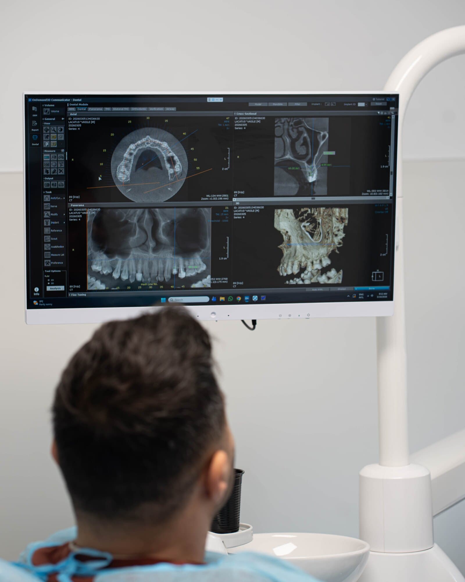 Aligneri Spark Advanced